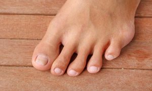 A Guide to the Importance of Surgery for Ingrown Toenails
