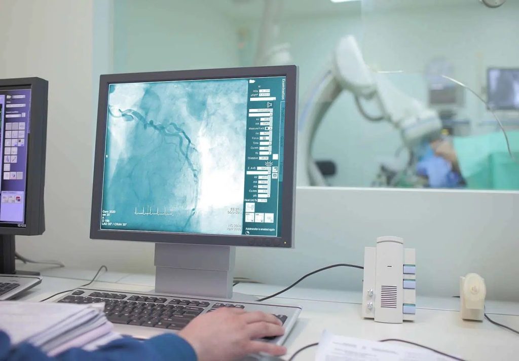 Angiogram Singapore: What’s the Main Reason for this Procedure?