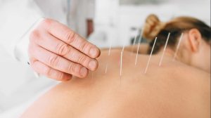 Acupuncture on Mental Health