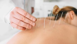 Acupuncture on Mental Health